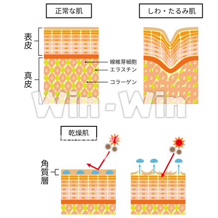 皮膚×3種のCG・イラスト素材 W-023180