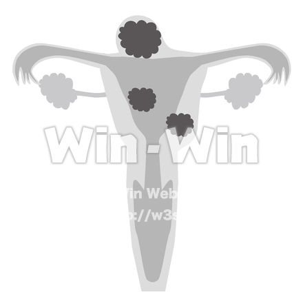 子宮筋腫三種のシルエット素材 W-025471